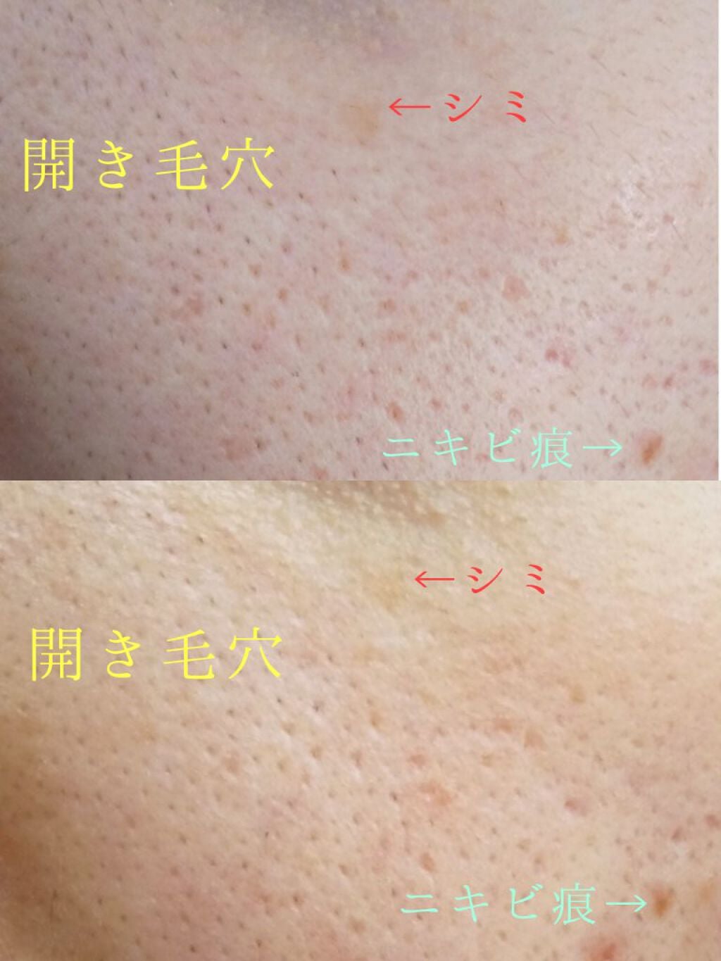 V エッセンス/unlabel/美容液を使ったクチコミ(2枚目)