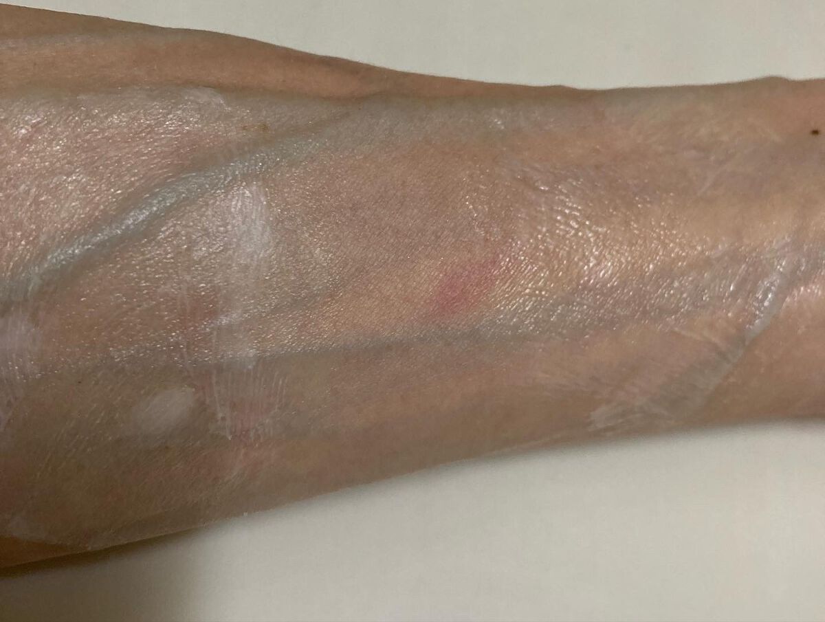 メディコル トライアルセット/ナノエッグ/スキンケアキットを使ったクチコミ(9枚目)