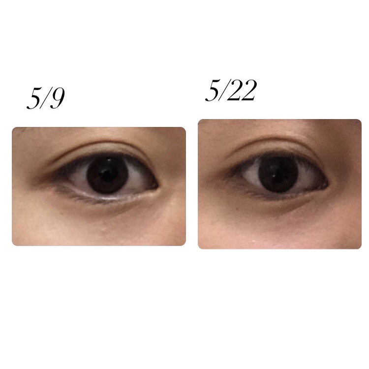 ごめんね素肌 クマらないアイクリーム/クリアターン/アイケア・アイクリームを使ったクチコミ（2枚目）