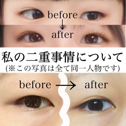 アイテープ(絆創膏タイプ、レギュラー、70枚)/DAISO/二重まぶた用アイテムを使ったクチコミ(1枚目)