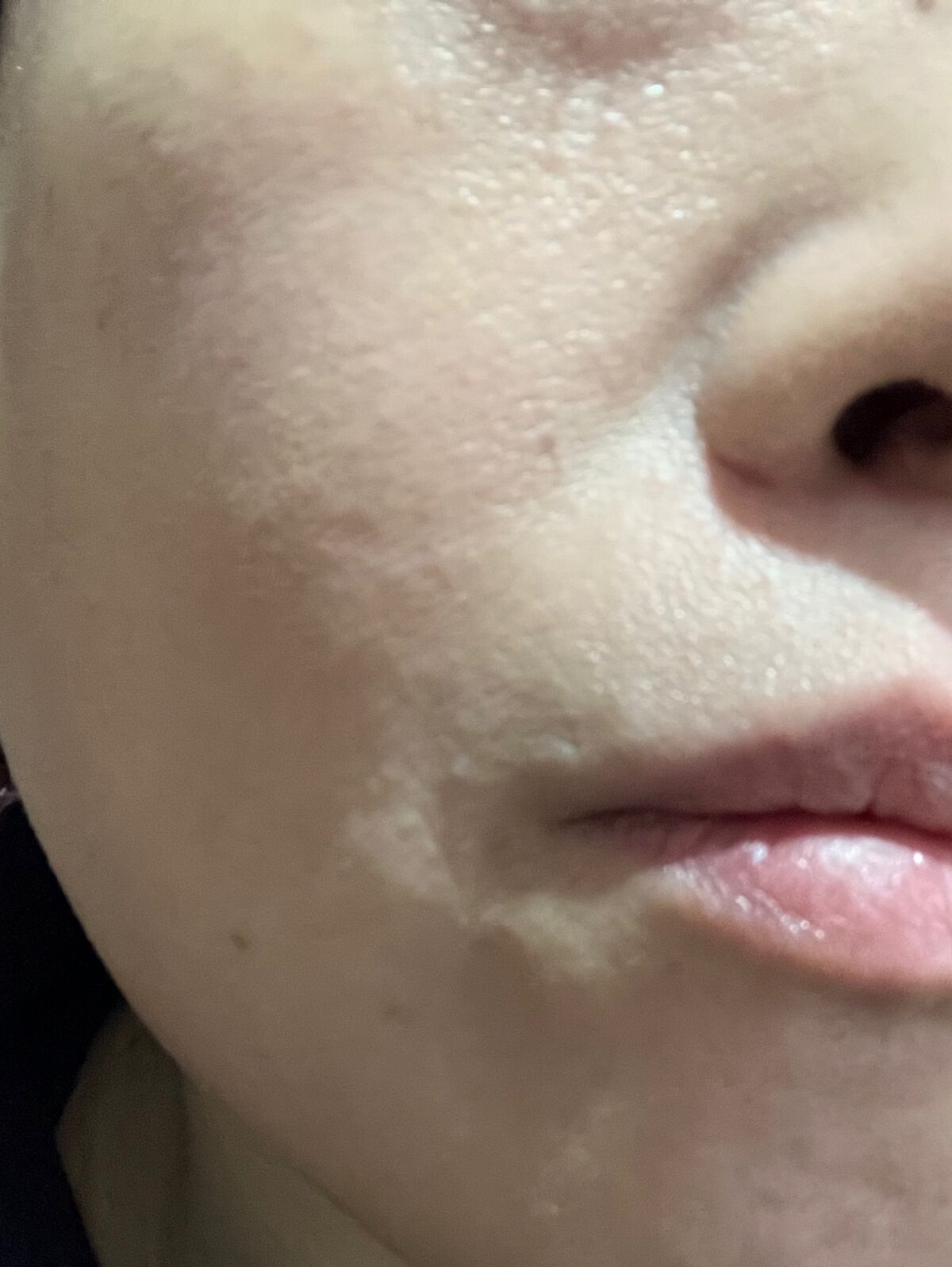 こまっきーファンデーション /Komacky/リキッドファンデーションを使ったクチコミ(4枚目)