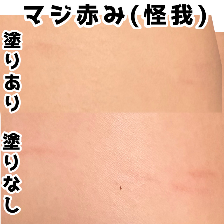 アンリミテッド ケア ツヤ セラム ファンデーション/shu uemura/リキッドファンデーションを使ったクチコミ（2枚目）