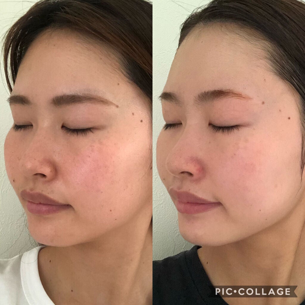 ミラミックス/ZO Skin Health/フェイスクリームを使ったクチコミ(2枚目)