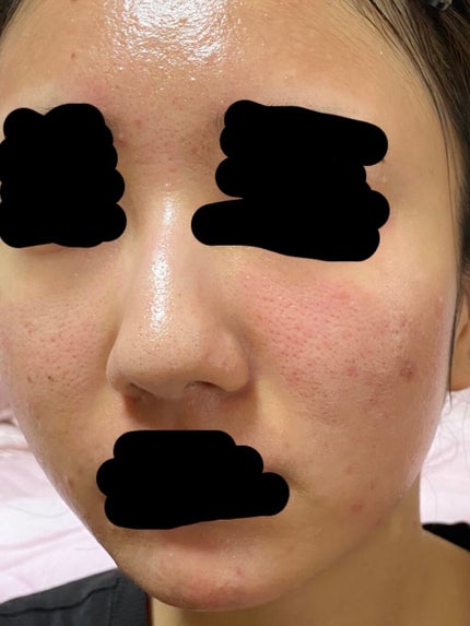 を使ったクチコミ(2枚目)