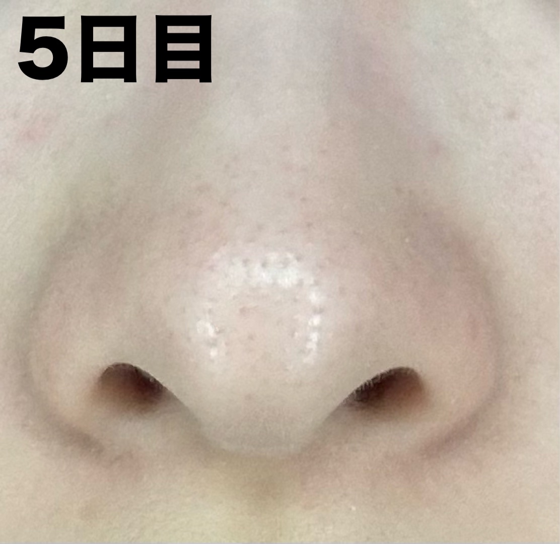 デュオ ザ ウォッシュ ブラックリペア/DUO/洗顔パウダーを使ったクチコミ（2枚目）