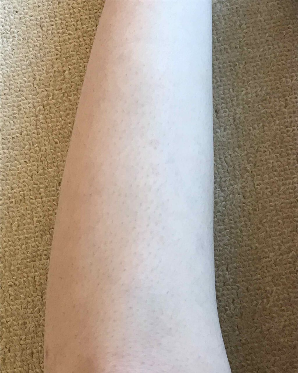 つるすべ除毛パッド/DAISO/ムダ毛ケアを使ったクチコミ（2枚目）
