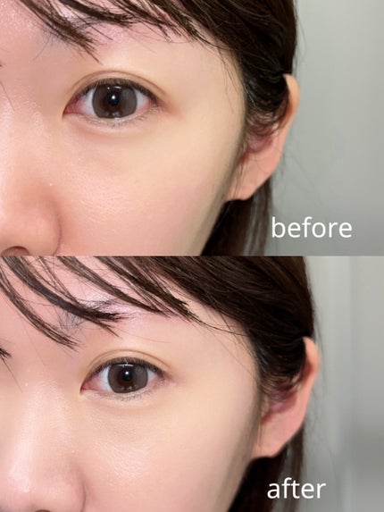 アイレノール クマクリーム/IRENOL/アイケア・アイクリームを使ったクチコミ(4枚目)