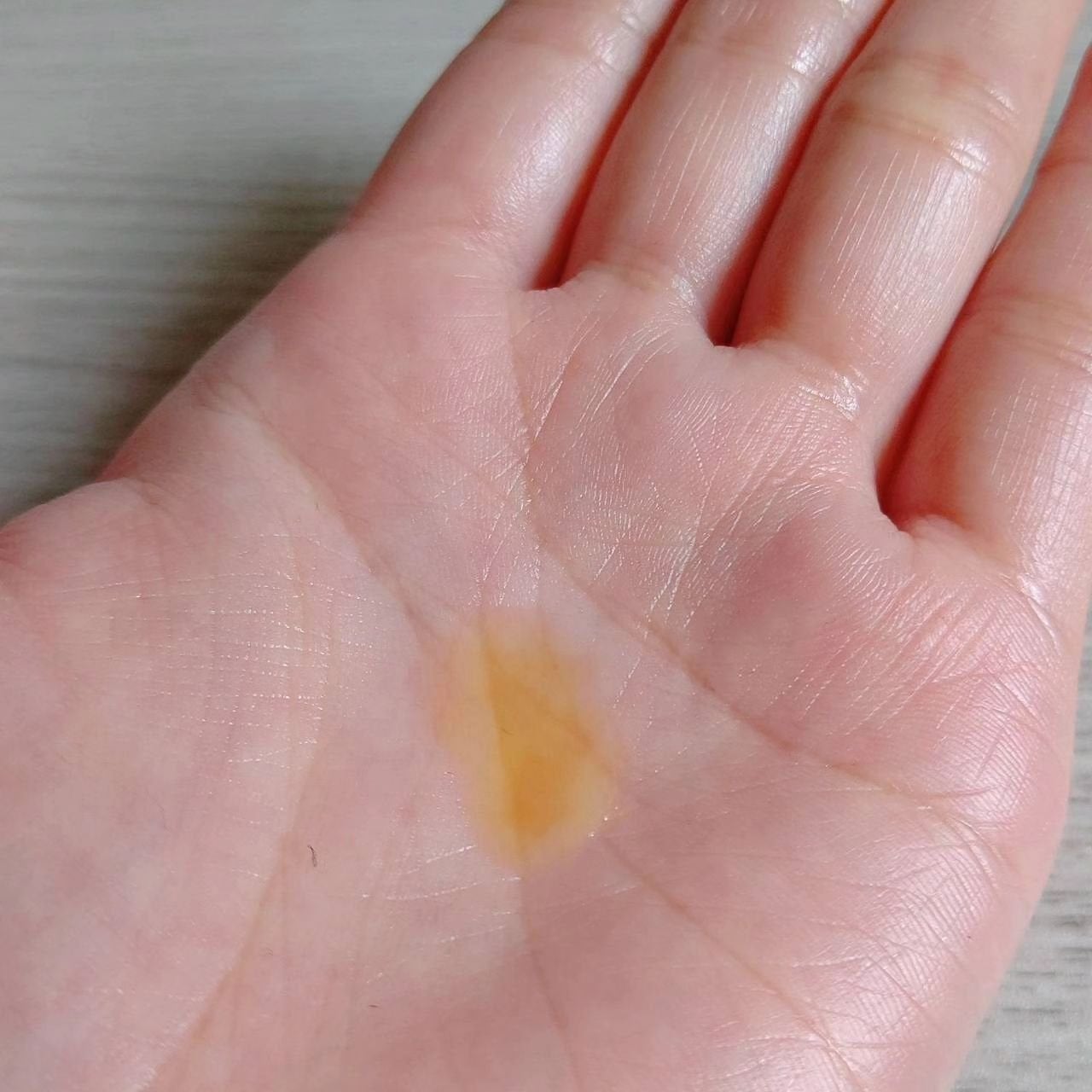 レッドアクネピーリングセラム/MEDICUBE/美容液を使ったクチコミ(7枚目)