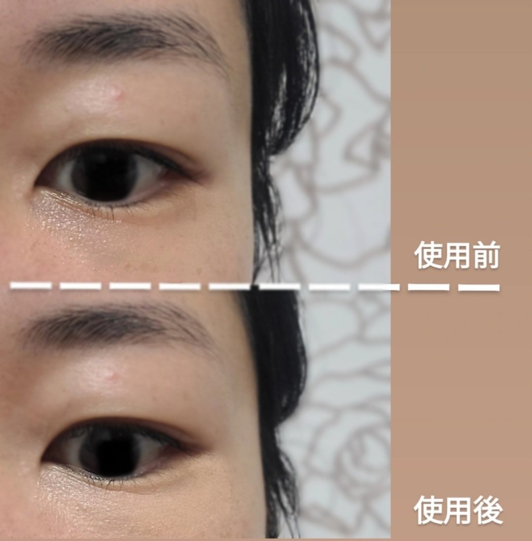 アイレノール クマクリーム/IRENOL/アイケア・アイクリームを使ったクチコミ（3枚目）