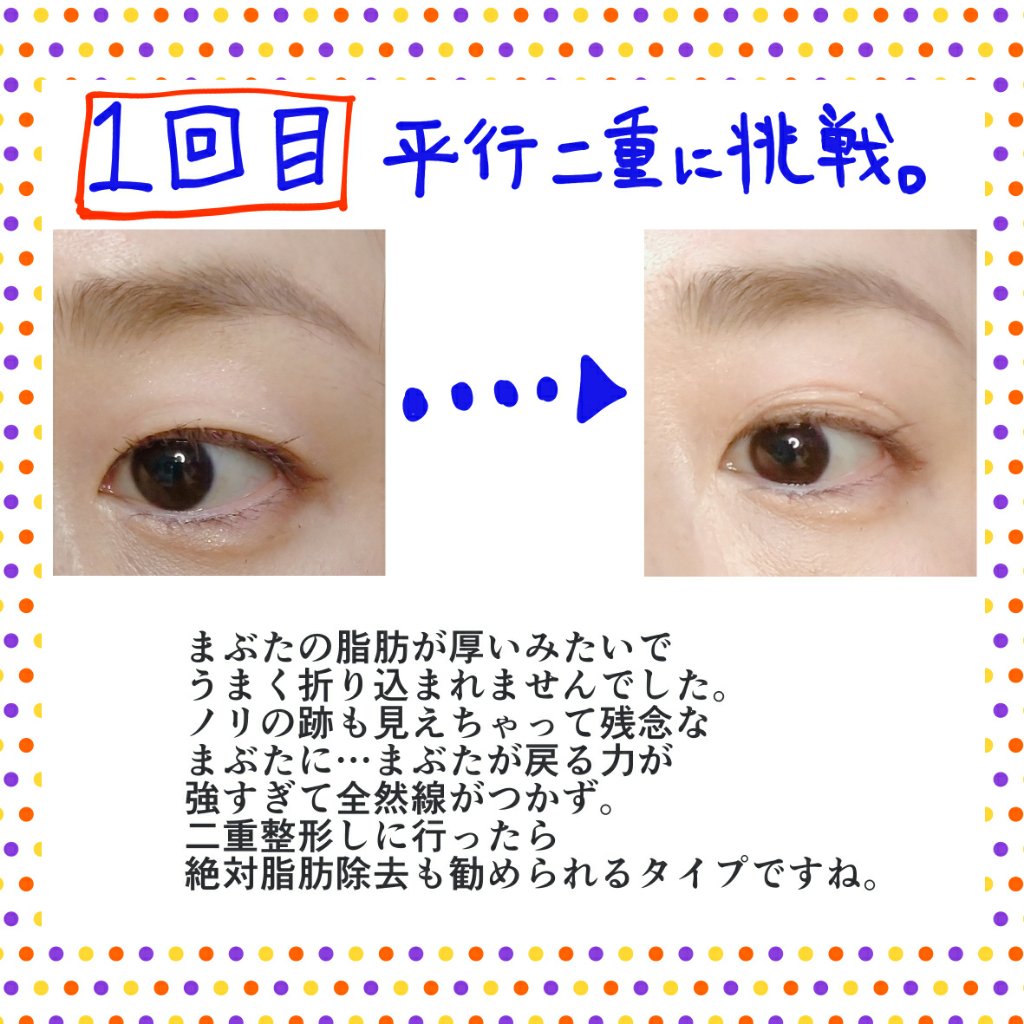 ルドゥーブル プレミアム/ルドゥーブル/二重まぶた用アイテムを使ったクチコミ（3枚目）