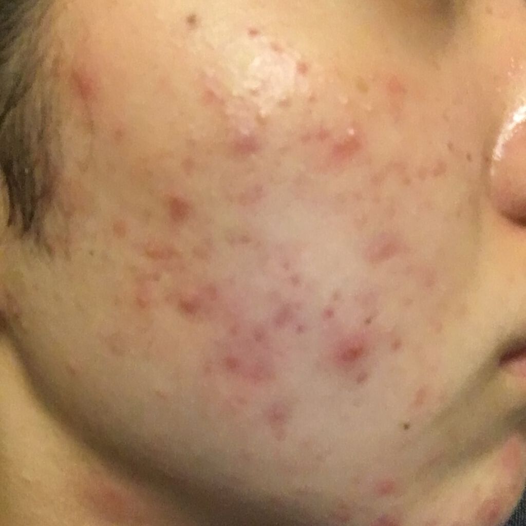 デュオ ザ クレンジングバーム/DUO/クレンジングバームを使ったクチコミ（2枚目）