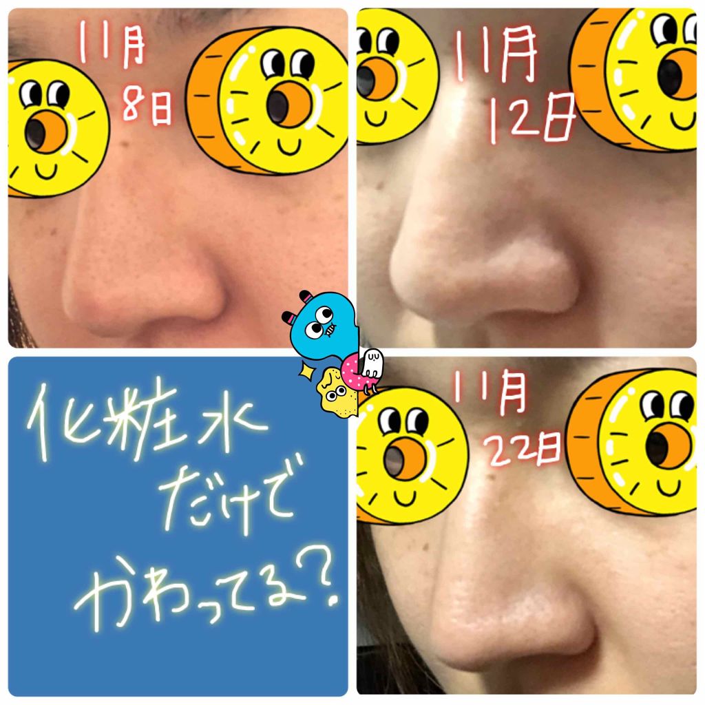 スムースローション/skinvill/化粧水を使ったクチコミ（1枚目）