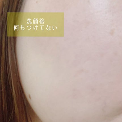 フルフィットプロポリスシナジートナー/COSRX/化粧水を使ったクチコミ(4枚目)