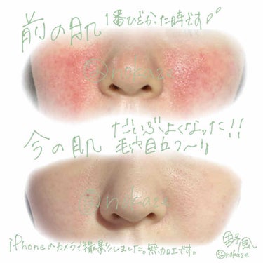 美顔 明色 美顔水 薬用化粧水のクチコミ「

\ 肌荒れに悩んでる人、是非見て。 /

こんにちは、野風です🍃

(間違えて投稿消してし.....」（2枚目）