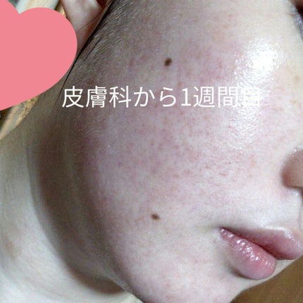 セラネージュ UVクリーム/CeraLabo/日焼け止めクリームを使ったクチコミ(3枚目)