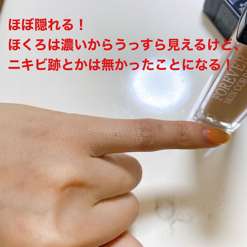 【旧】ディオールスキン フォーエヴァー スキン コレクト コンシーラー/Dior/リキッドコンシーラーを使ったクチコミ(5枚目)
