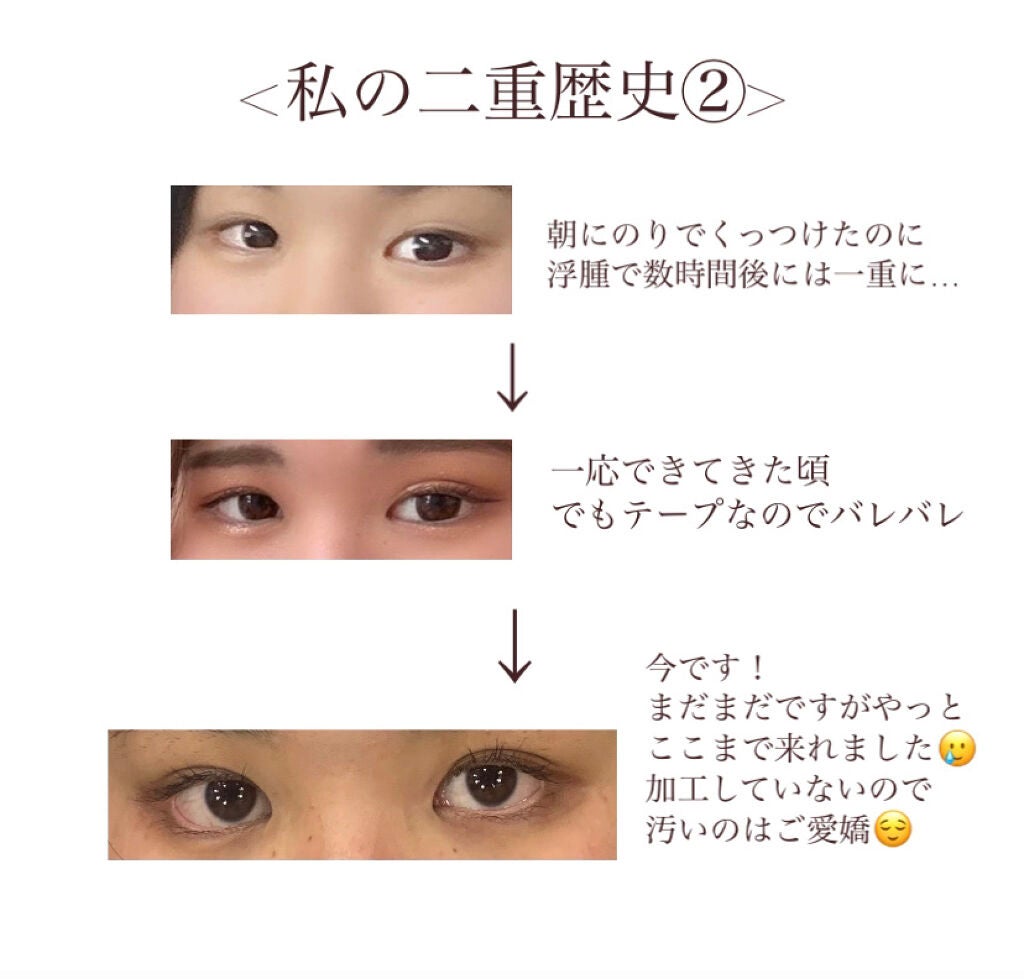 のび〜る アイテープ 両面テープタイプ/DAISO/二重まぶた用アイテムを使ったクチコミ(3枚目)