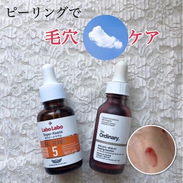 AHA 30% + BHA 2% Peeling Solution/The Ordinary/ピーリングを使ったクチコミ（1枚目）