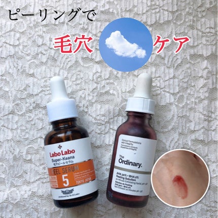 AHA 30% + BHA 2% Peeling Solution/The Ordinary/ピーリングを使ったクチコミ(1枚目)