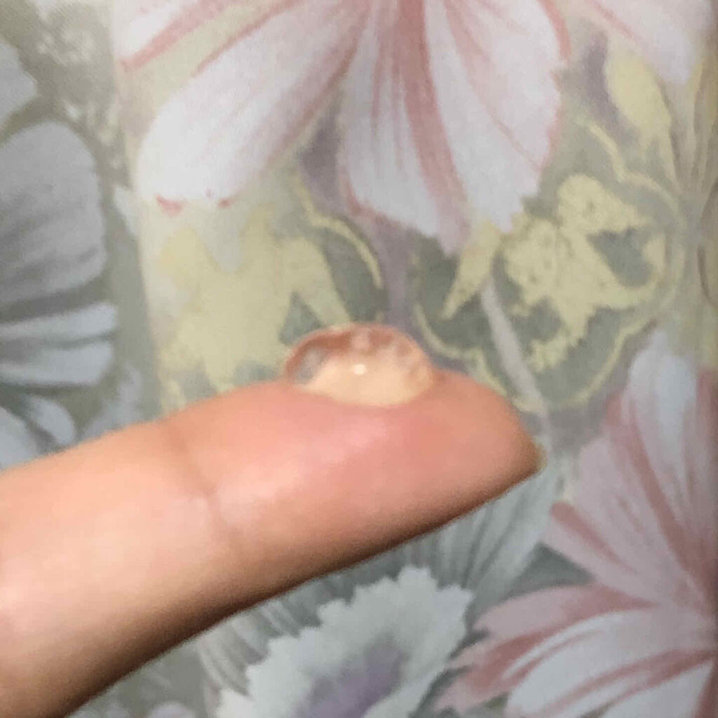 モイスチャー サージ 96 アイ コンセントレート/CLINIQUE/アイケア・アイクリームを使ったクチコミ（3枚目）