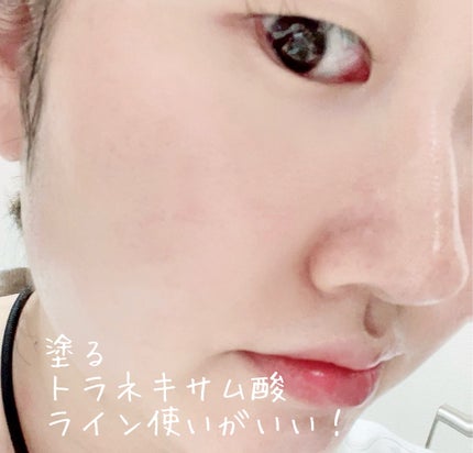 TX-Cream/Dr.Melaxin/フェイスクリームを使ったクチコミ(4枚目)