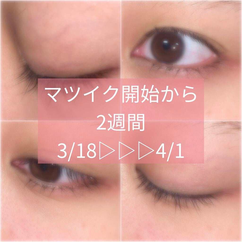 ラッシュアディクト アイラッシュコンディショニングセラム/soaddicted/まつげ美容液を使ったクチコミ(1枚目)