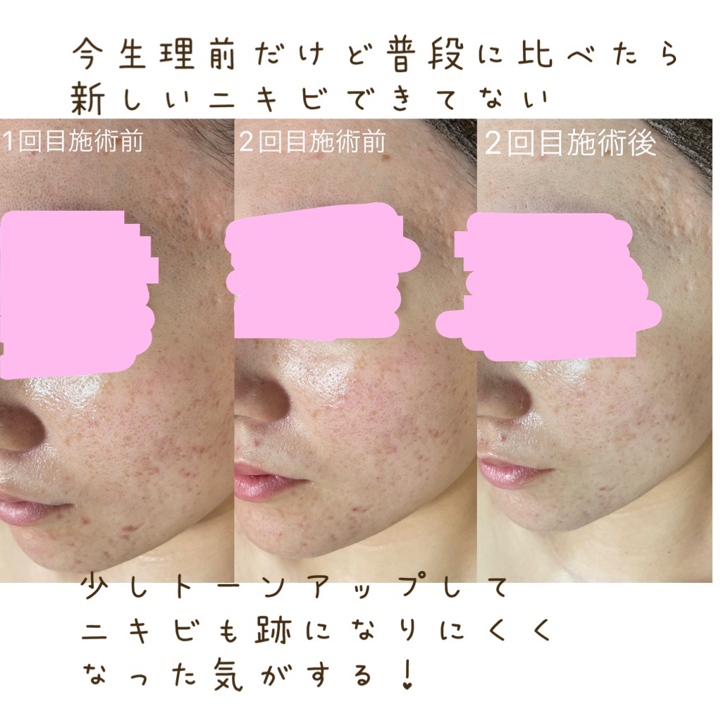 を使ったクチコミ（2枚目）