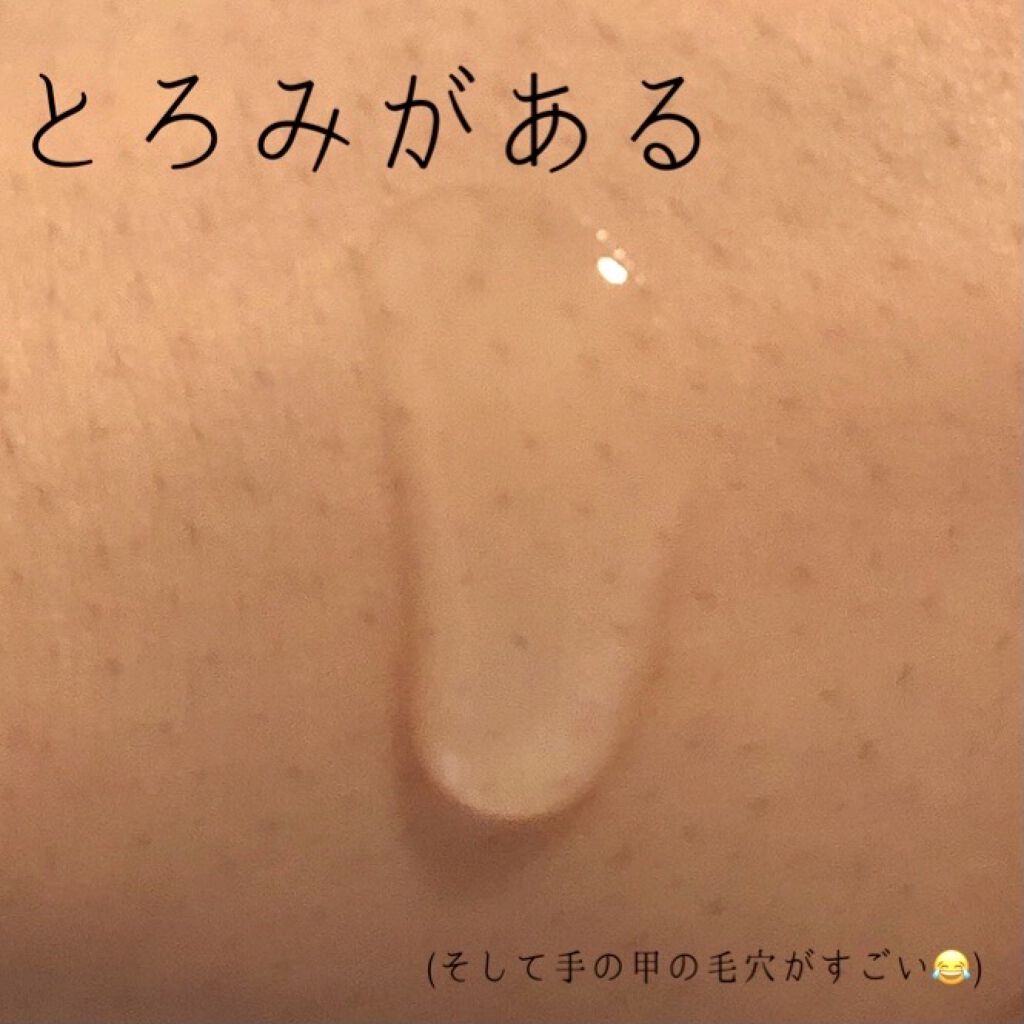 美白美容液 VC/ちふれ/美容液を使ったクチコミ（3枚目）