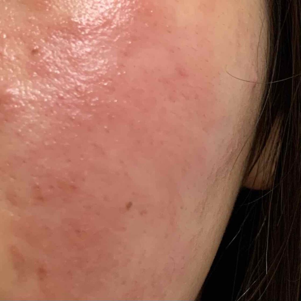 momo on LIPS ãðš2æç®æ³šæðšãçžè«ããããªã²ã«ã«ã€ããŠç®èç§ã«è¡ã£ãã€ãã§ã«..ãïŒ2æç®ïŒ