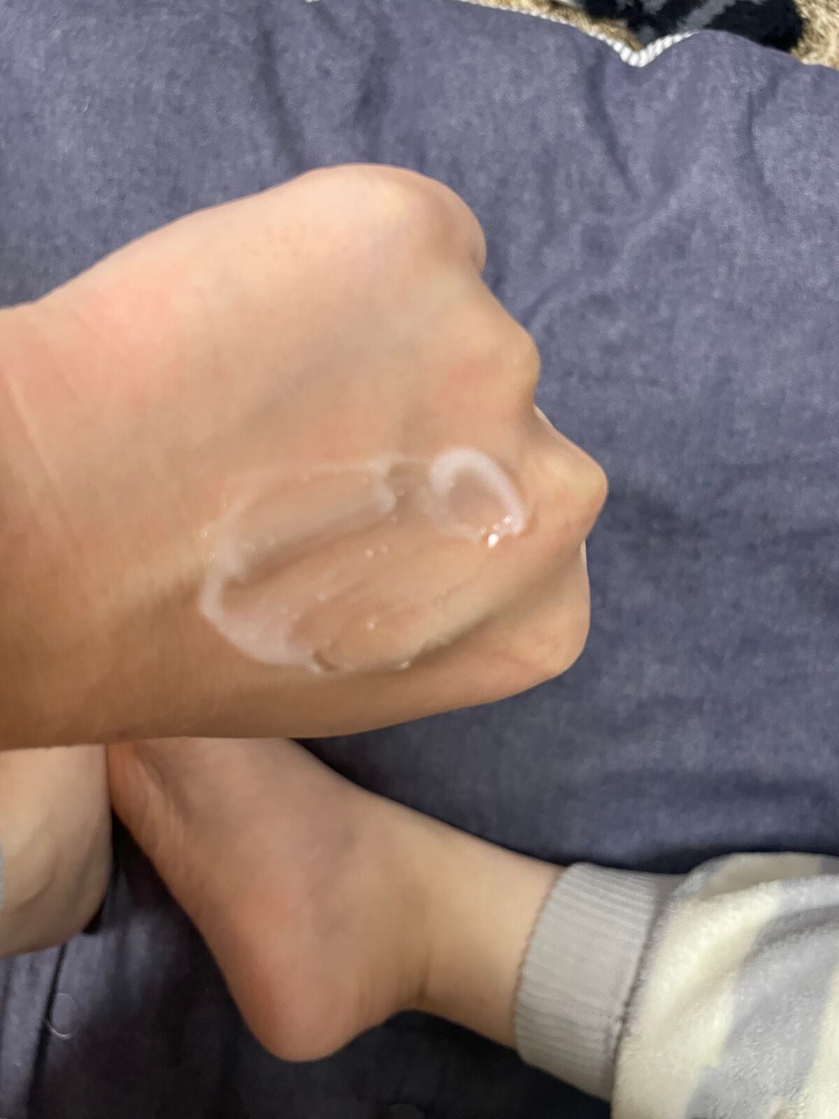 デュイセル シカプラスバーム/DEWYCEL/フェイスクリームを使ったクチコミ(3枚目)