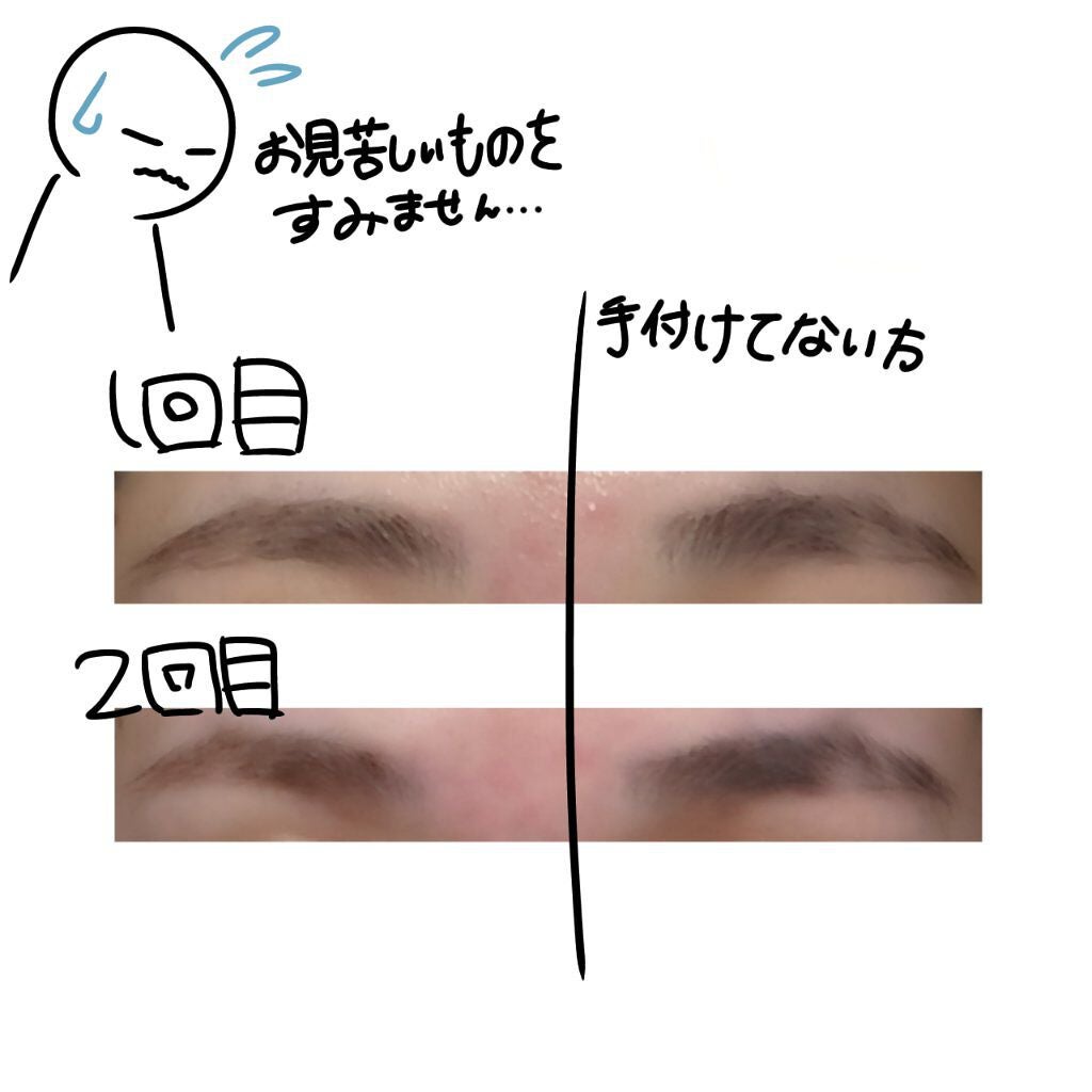 脱色クリーム スピーディー/エピラット/ムダ毛ケアを使ったクチコミ(3枚目)