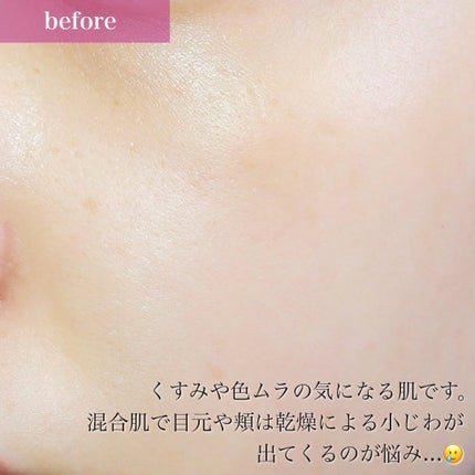 ベアプロ 16HR オールオーバー コンシーラー SPF25(PA+++)/bareMinerals/リキッドコンシーラーを使ったクチコミ(5枚目)