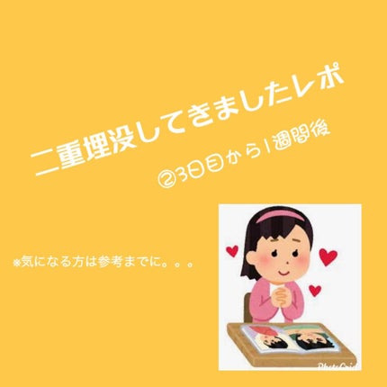 二重整形/その他を使ったクチコミ(1枚目)