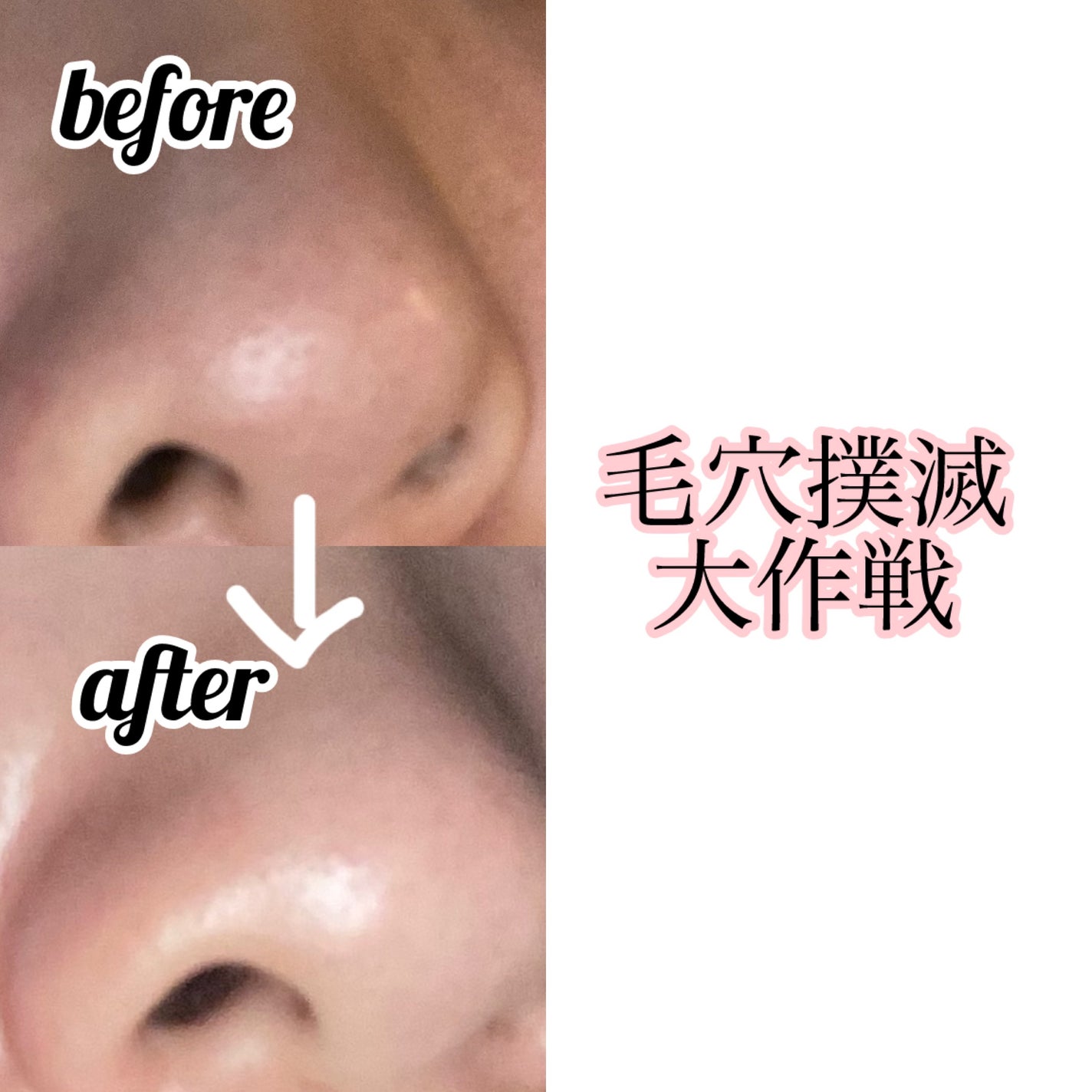 ハトムギ化粧水(ナチュリエ スキンコンディショナー R )/ナチュリエ/化粧水を使ったクチコミ(1枚目)