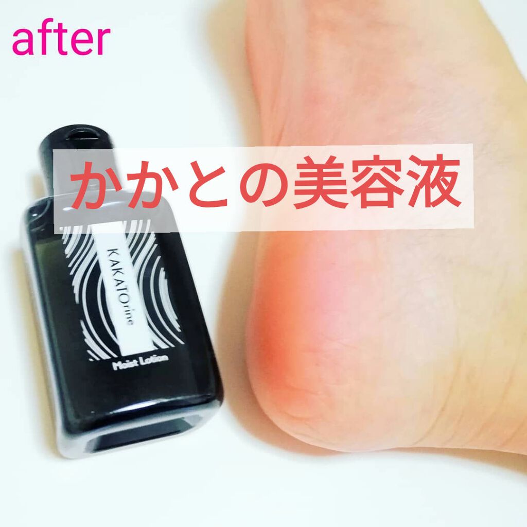 カカトリーヌモイストローション/KAKATOrine/レッグ・フットケアを使ったクチコミ(1枚目)
