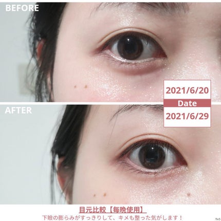 ã°ã©ã³ ã¢ã€ ã»ã©ã V/CLARINS/ã¢ã€ã±ã¢ã»ã¢ã€ã¯ãªãŒã ã䜿ã£ãã¯ãã³ãïŒ4æç®ïŒ