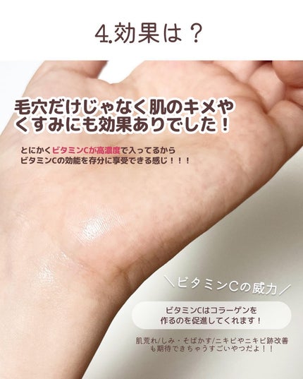 VC100エッセンスローション EX/ドクターシーラボⓇ/化粧水を使ったクチコミ(6枚目)