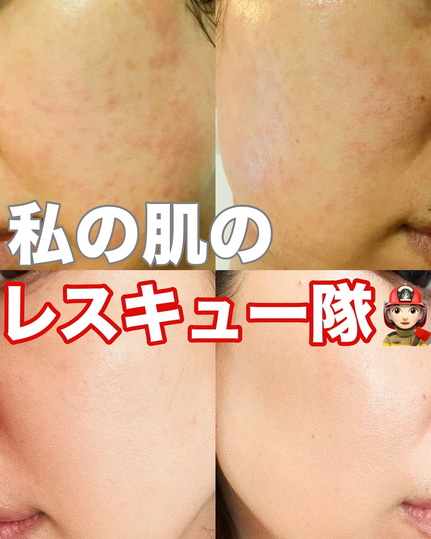 ノスカナイン トラブル セラム/FATION/美容液を使ったクチコミ（1枚目）