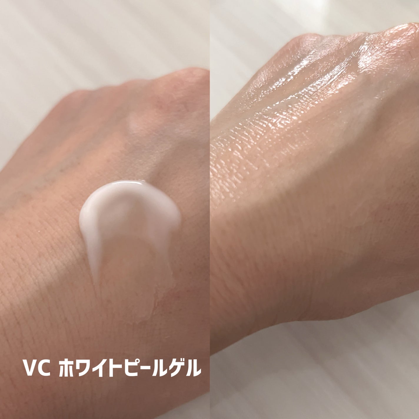 SKIOトライアルキット/SKIO/トライアルキットを使ったクチコミ(4枚目)