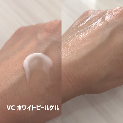 SKIOトライアルキット/SKIO/トライアルキットを使ったクチコミ(4枚目)