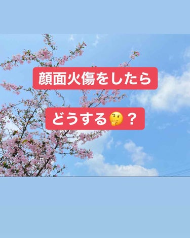 

皆さんこんばんは！
今日は自分用メモも兼ねて

顔面火傷の対処法をここに残そうと思います👏🏻

はい！私はいちご飴つくってたら飴が跳ねてⅡ度の熱傷の顔面火傷をおいました👏🏻
まじで泣きそうでした👏🏻