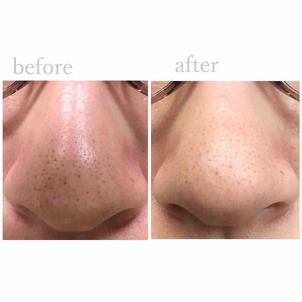 ガスール固形/ナイアード/洗顔フォームを使ったクチコミ(3枚目)