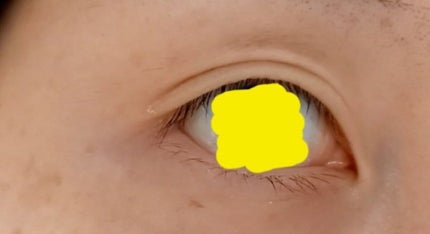 TWOOLダブルアイリッドハイブリットフィルム/SHOBIDO/二重まぶた用アイテムを使ったクチコミ(3枚目)