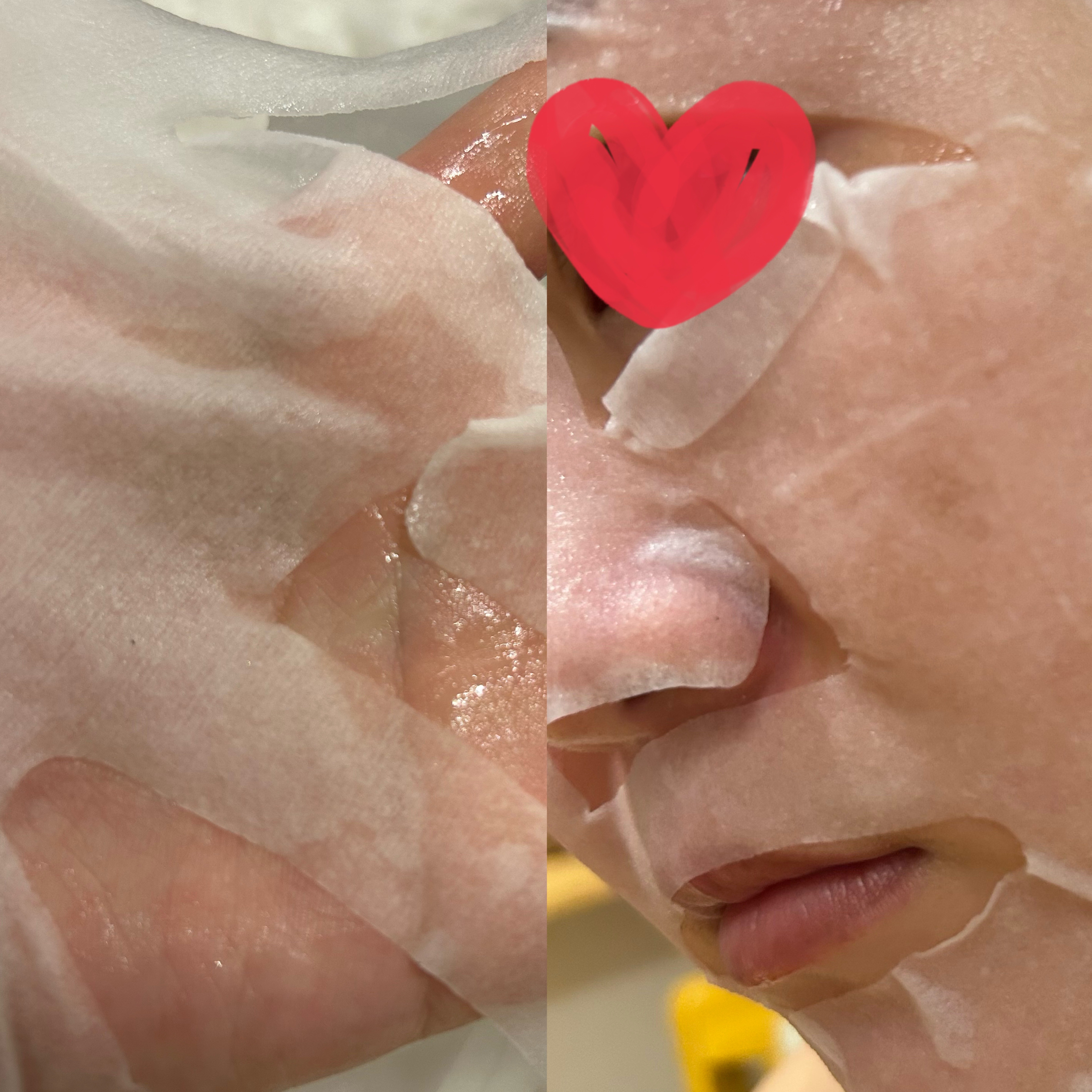 EX VCセラムマスク/EXO LABO/シートマスク・パックを使ったクチコミ（3枚目）