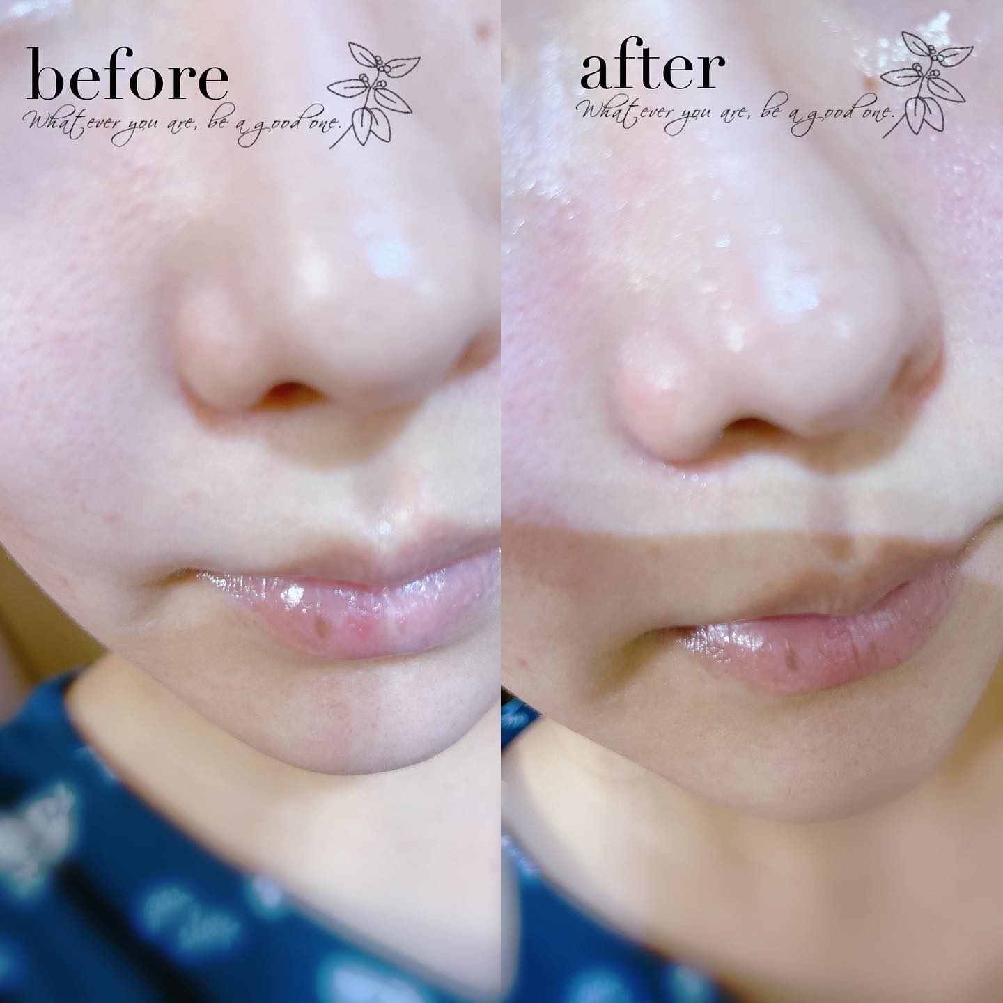 チョコブラ スペシャル毛穴ケアセット/Chocobra/スキンケアキットを使ったクチコミ（3枚目）