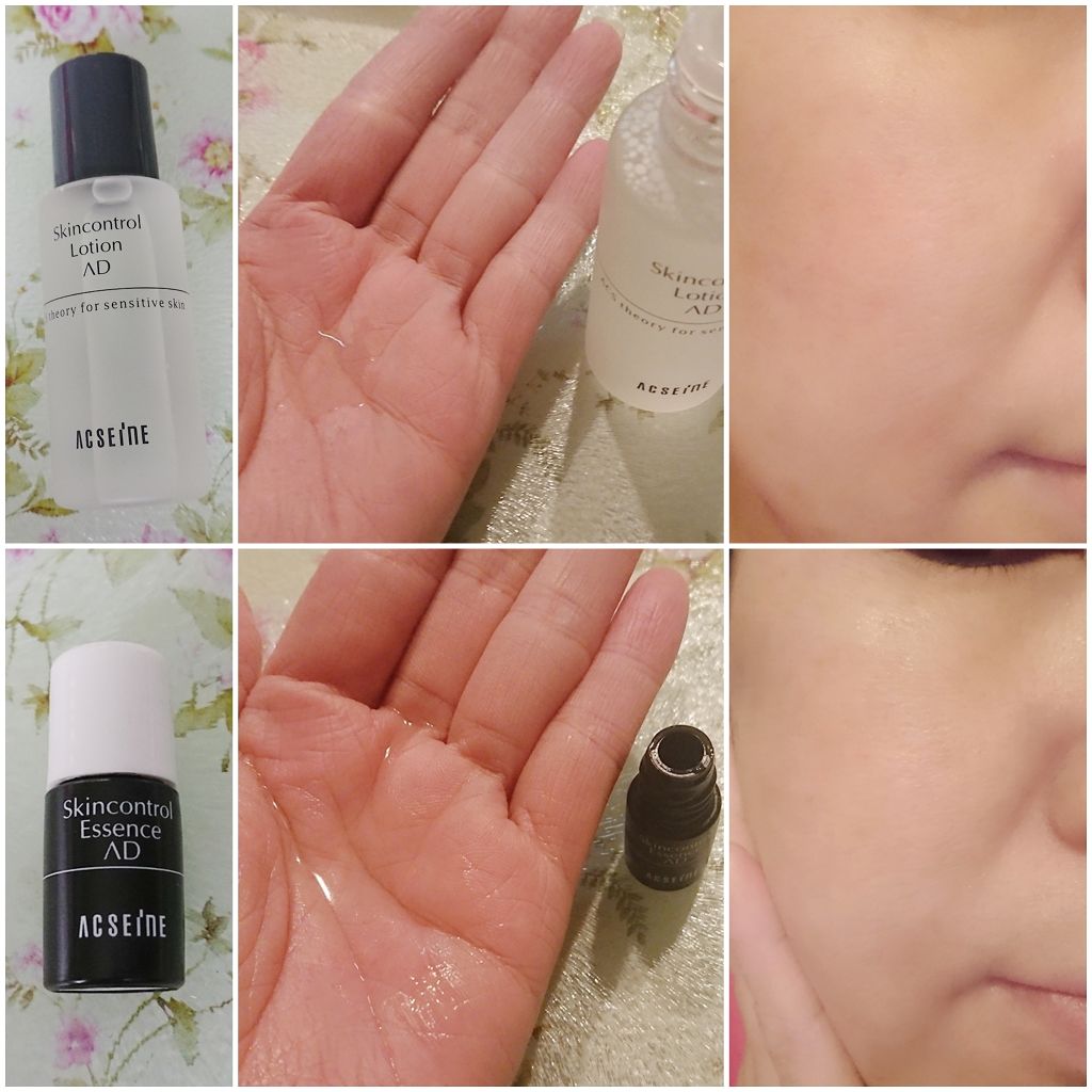スキンケアプログラム AD/ACSEINE/トライアルキットを使ったクチコミ（3枚目）