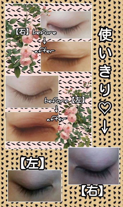 EGUTAM エグータム/アルマダスタイル/まつげ美容液を使ったクチコミ(2枚目)