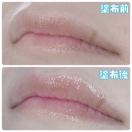 ガラスプランパー/CipiCipi/リッププランパーを使ったクチコミ(5枚目)