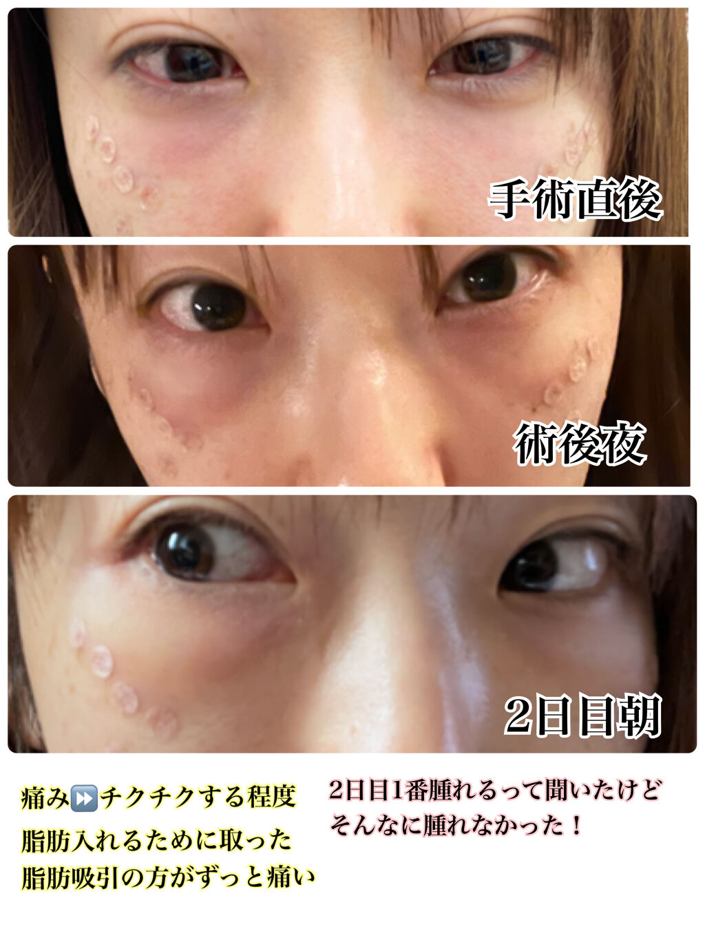 ディエム クルール カラーブレンドパウダーコンシーラー/ディエム クルール/パウダーコンシーラーを使ったクチコミ（2枚目）