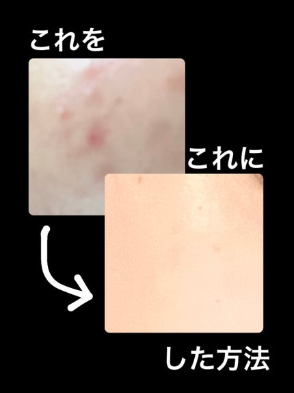 ハトムギ化粧水(ナチュリエ スキンコンディショナー R )/ナチュリエ/化粧水を使ったクチコミ(1枚目)